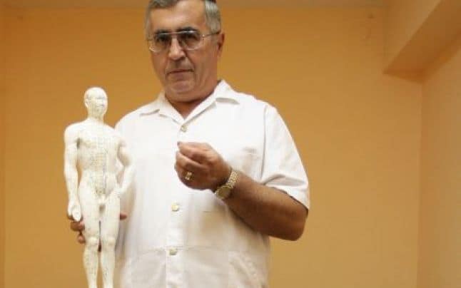 acupunctura craiova